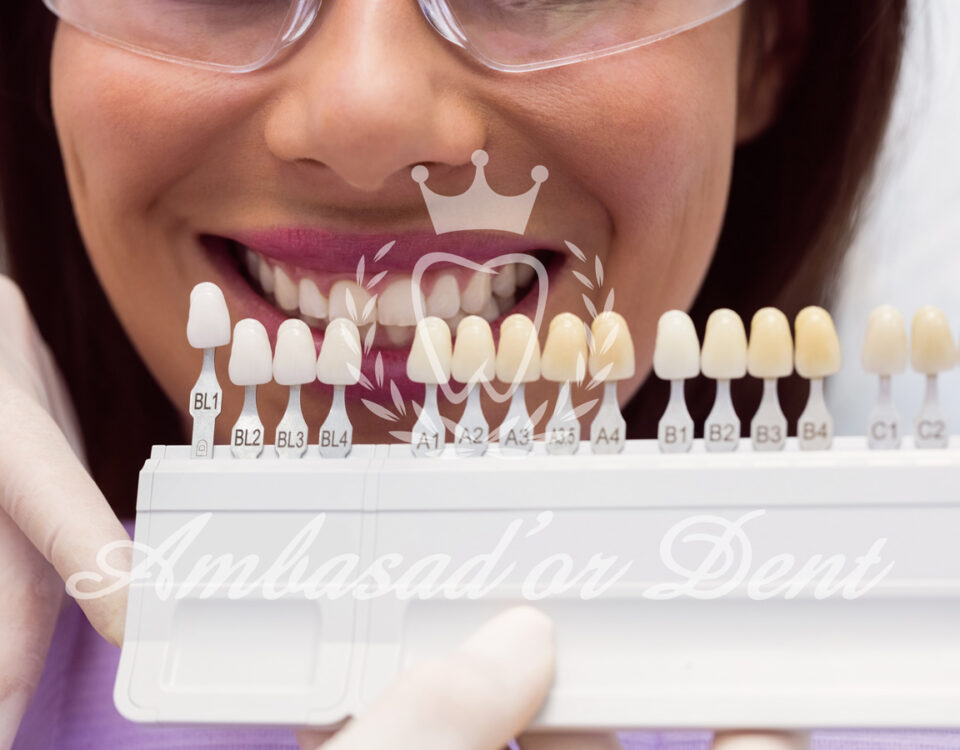 Alegerea corectă între implant dentar și punte