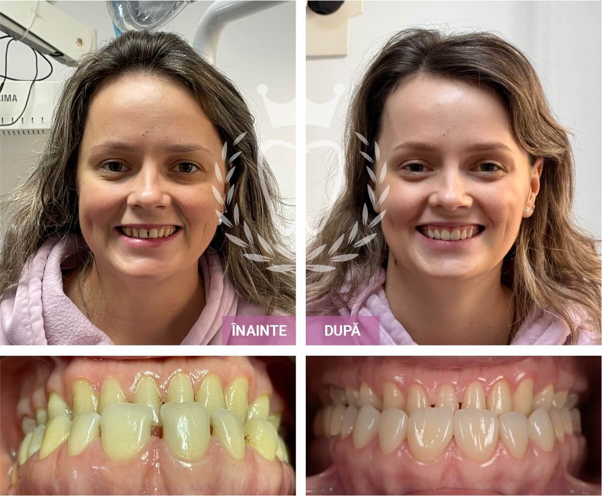 cele-mai-bune-cabinete-stomatologice-piatra-neamt